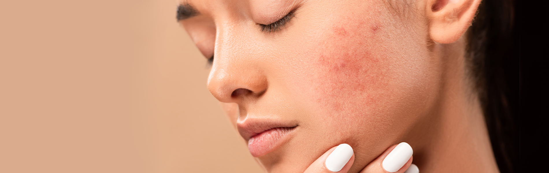 Skin Concerns